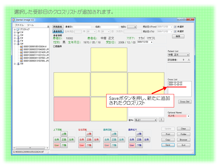 クロス追加