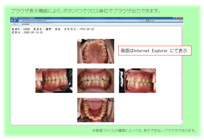 ブラウザ