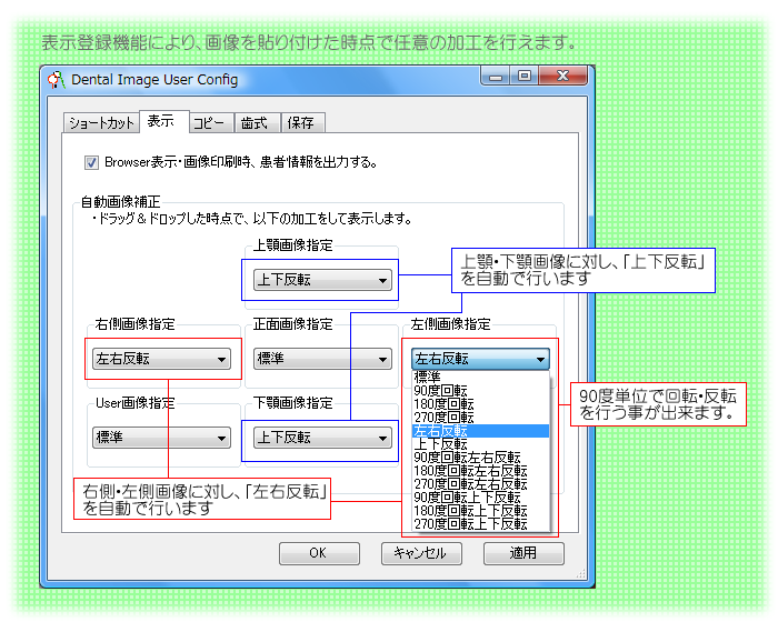 表示